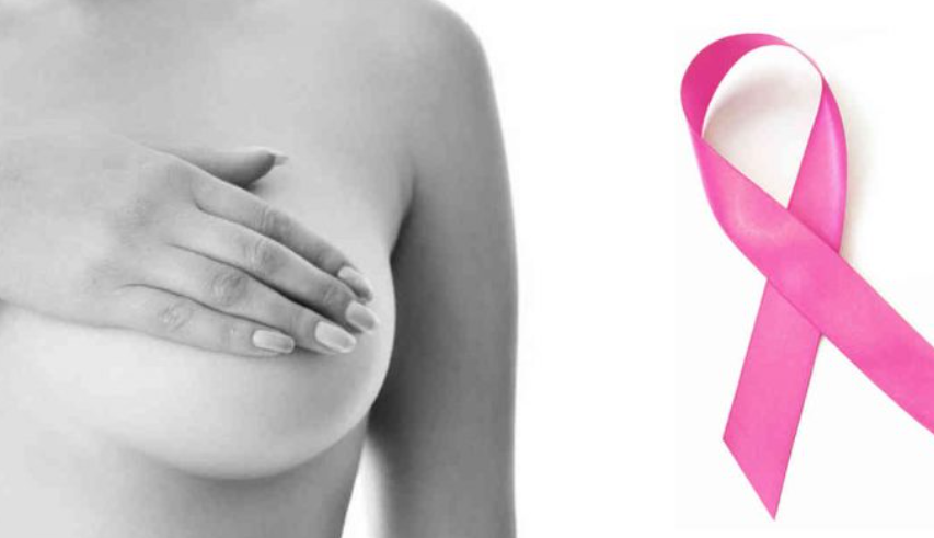 Cancelan NOMs sobre cáncer de mama