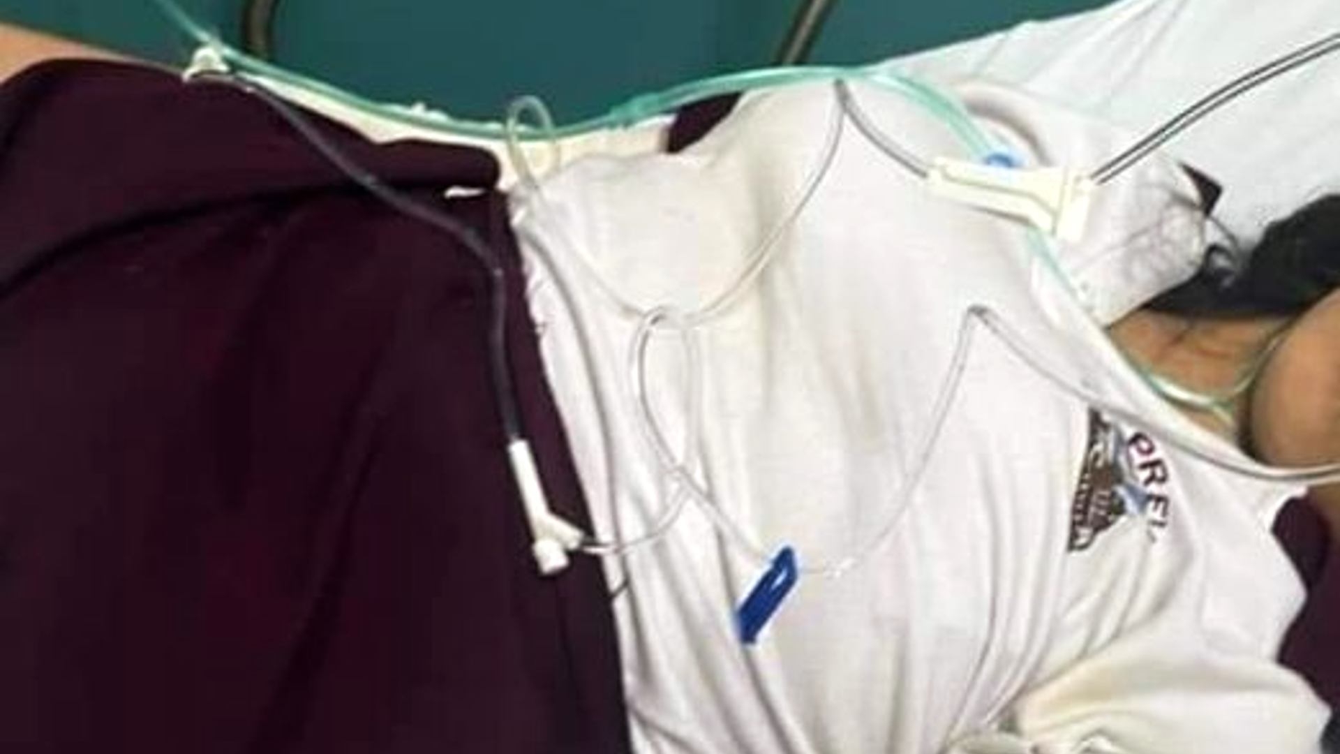 Hospitalizan a alumna tras agresión en Yucatán; hemorragia cerebral
